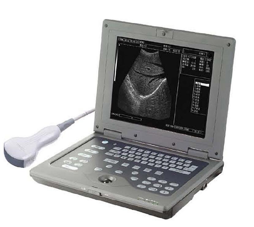 의료 초음파 기기 노트북 초음파 기계 B/W 휴대용 디지털 초음파 스캐너